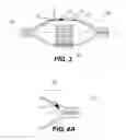 Fig. 05 - INFLATABLE DEVICE WITH ETCHED MODIFICATIONS