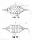 Fig. 09 - INFLATABLE DEVICE WITH ETCHED MODIFICATIONS