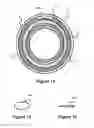 Fig. 11 - Reinforced balloon catheter