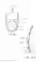 Fig. 12 - Implant magnet system