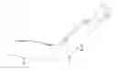 Fig. 01 - Feedback-control wearable upper-limb electrical stimulation device