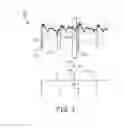Fig. 12 - Atrial synchronized ventricular pacing system using intracardiac pacemaker and extracardiac atrial sensing