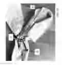 Fig. 04 - Cloth back support apparatus and methods of use