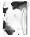 Fig. 17 - Cloth back support apparatus and methods of use