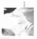 Fig. 20 - Cloth back support apparatus and methods of use