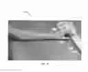 Fig. 09 - Hand exercise device
