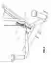 Fig. 04 - CONTROL SYSTEM FOR EXERCISE MACHINE