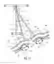 Fig. 11 - Snow ski training apparatus and methods of use