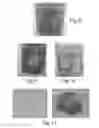 Fig. 06 - Filtration system