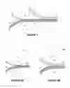 Fig. 02 - FILTER MEDIA AND METHODS OF MANUFACTURING THEREOF