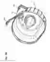Fig. 75 - Filter cartridge arrangements and assemblies; preferred features; methods of assembly and use