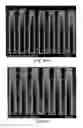 Fig. 57 - Devices and method for enrichment and alteration of cells and other particles