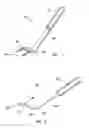 Fig. 02 - POCKET FORMER REMOVAL TOOL