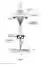 Fig. 08 - Meltblown method for producing nonwoven fabrics with hygroscopic metastatic feature