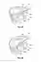 Fig. 05 - Mirror actuator for vehicle
