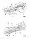 Fig. 04 - Camera assembly for a vehicle, and vehicle having such a camera assembly