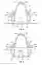 Fig. 03 - Retention clip for interior vehicle components