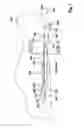 Fig. 06 - Wiper arm wind deflector unit