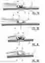 Fig. 04 - Windscreen wiper device
