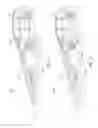 Fig. 03 - Vehicle underside impact avoidance