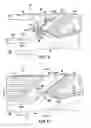 Fig. 04 - Vehicle front end structure