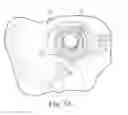 Fig. 19 - Nested blow molded liner and overpack and methods of making same