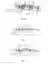 Fig. 06 - Banknote stacking device