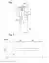 Fig. 02 - Method for controlling unintended vertical speed and acceleration of an elevator