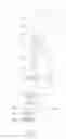 Fig. 02 - Water Purification Valve Core