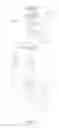 Fig. 05 - Water Purification Valve Core