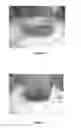 Fig. 05 - Organic waste processing