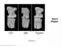 Fig. 33 - Nuclear transport modulators and uses thereof