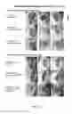 Fig. 36 - Nuclear transport modulators and uses thereof