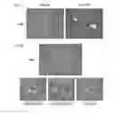 Fig. 06 - CETP antigenic peptide and fusion protein and their composition and applications