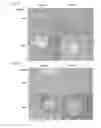 Fig. 07 - CETP antigenic peptide and fusion protein and their composition and applications