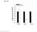 Fig. 08 - CETP antigenic peptide and fusion protein and their composition and applications
