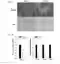 Fig. 09 - CETP antigenic peptide and fusion protein and their composition and applications