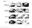 Fig. 09 - Composition for Intraocular Implantation of Bevacizumab