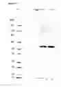 Fig. 14 - Composition for Intraocular Implantation of Bevacizumab