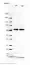 Fig. 16 - Composition for Intraocular Implantation of Bevacizumab