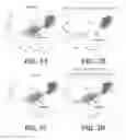 Fig. 04 - Effector-deficient anti-CD32A antibodies