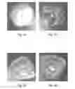 Fig. 02 - ASPHALTENE-DISSOLVING OIL-EXTERNAL EMULSION FOR ACIDIZATION AND METHODS OF USING THE SAME