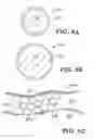 Fig. 03 - Encapsulated proppants