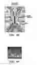 Fig. 12 - INTEGRATED HUMAN ORGAN-ON-CHIP MICROPHYSIOLOGICAL SYSTEMS