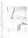 Fig. 06 - Differentiated Pluripotent Stem Cell Progeny Depleted of Extraneous Phenotypes