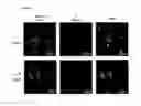 Fig. 07 - Kit and method for promoting mesenchymal stem cell differentiation