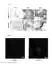Fig. 11 - Kit and method for promoting mesenchymal stem cell differentiation