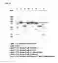 Fig. 12 - COMPOSITION AND FORMULATION COMPRISING RECOMBINANT HUMAN IDURONATE-2-SULFATASE AND PREPARATION METHOD THEREOF