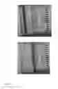 Fig. 23 - Methods and apparatuses for gene purification and imaging