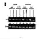 Fig. 04 - Dnazyme for silencing the expression of EGFR